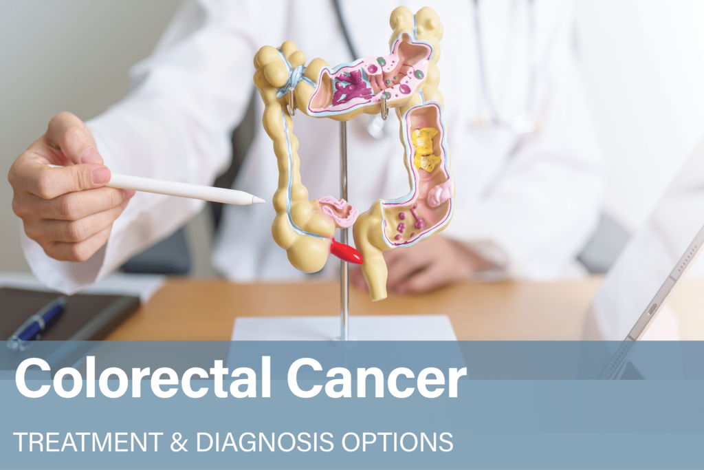 Colorectal Cancer Treatment Diagnosis Options