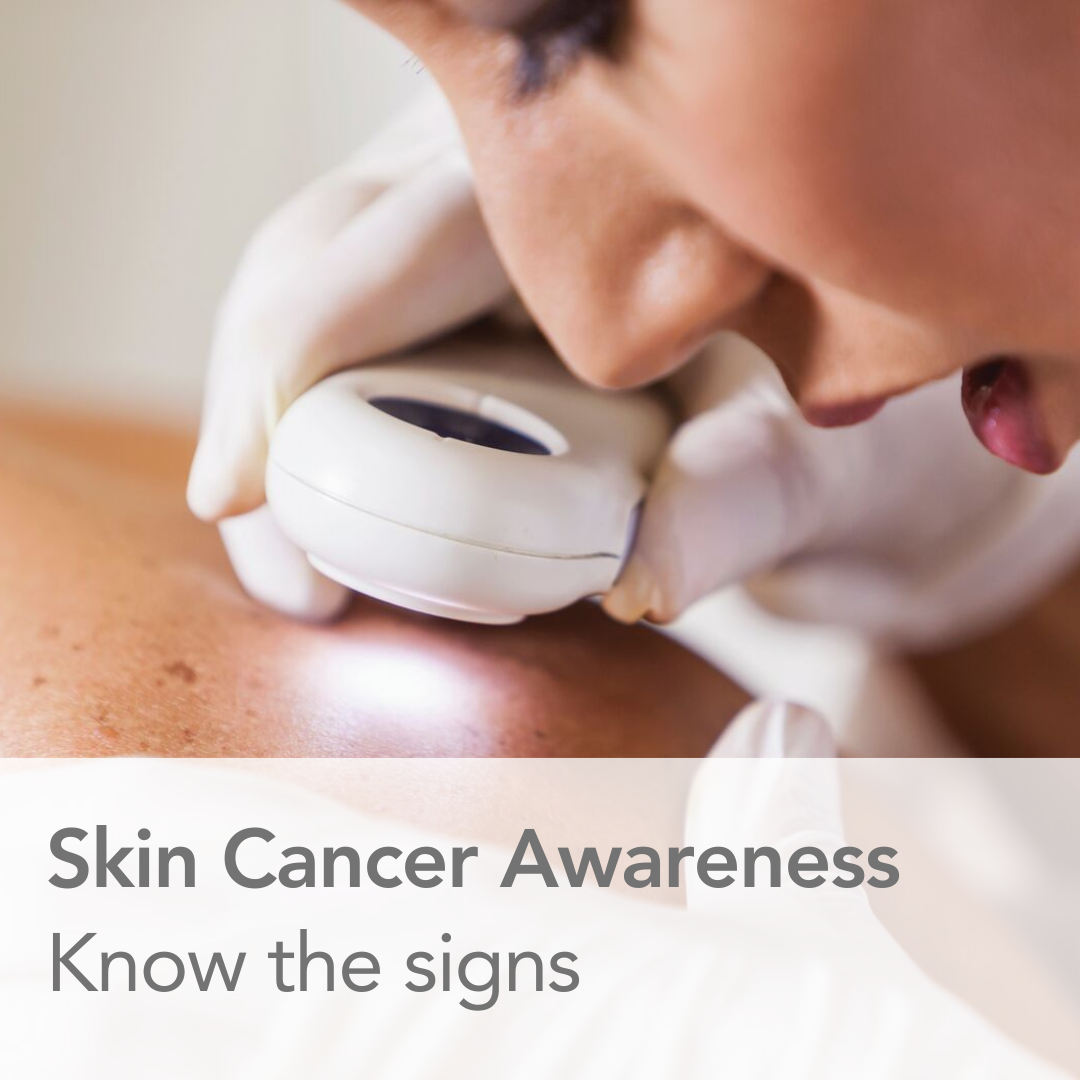 Skin Care at San Bernardino Cancer Care Center: What Patients Should Know